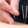 Here at North Cork Physiotherapy and Acupuncture Clinic we offer Dry Needling treatment. This treatment has become hugely popular due to its excellent ad rapid results.  It is widely used […]