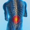 Most low back pain is due to minor sprains which are very painful but should heal completely and allow you return to full pain free movement. However in some cases […]